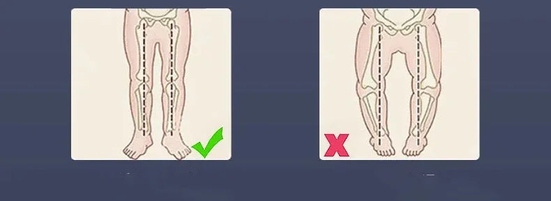 Multifunctional Baby Walker with Music-Anti O-shaped Legs & Anti-Fall Anti-Roll Design Suitable for Both Male and Female Infants